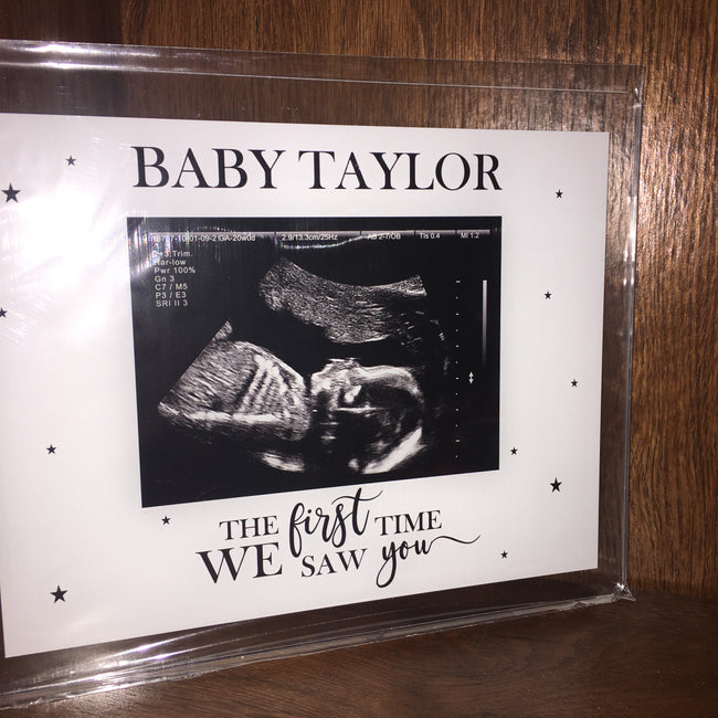 Ultrasound Plaque | UC BABY Collaboration