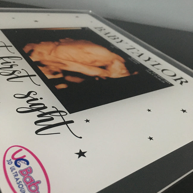 Ultrasound Plaque | UC BABY Collaboration